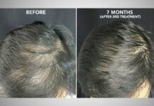 Regenerative Medicine & PRP (Platelet Rich Plasma)