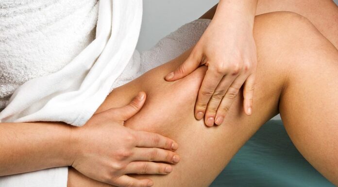 Cellulite: What really works?