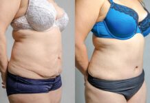 Lose that tummy BEFORE the holidays, not after!