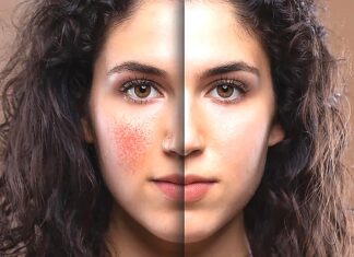 The Power of PRF and Benev Exosomes: Transforming Skin & Hair Health