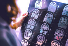 Veterans needed for Alzheimer’s Study