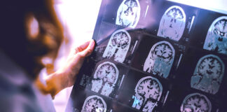 Veterans needed for Alzheimer’s Study